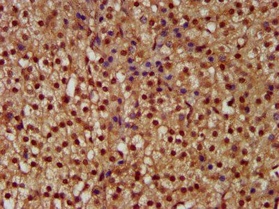 NEK1 Antibody