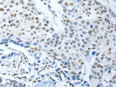 NEK4 Antibody