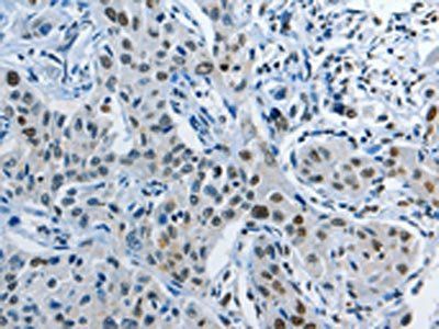 NEK4 Antibody