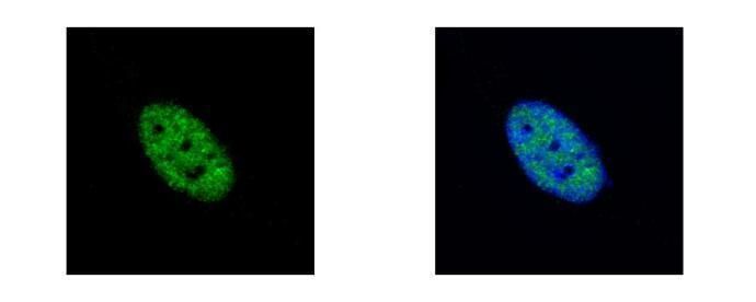 NEK4 Rabbit Polyclonal Antibody