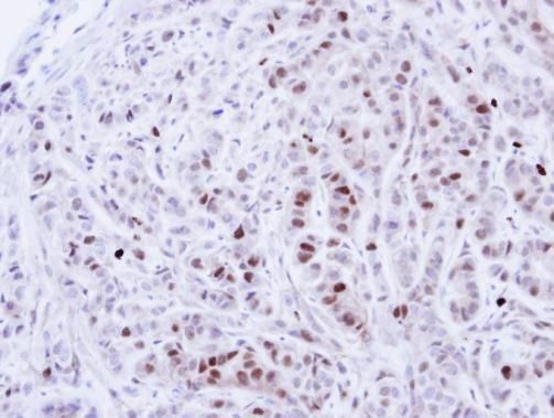 NEK4 Rabbit Polyclonal Antibody