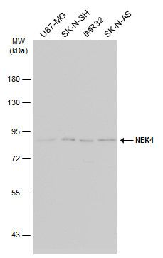 NEK4 Rabbit Polyclonal Antibody