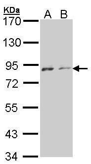NEK4 Rabbit Polyclonal Antibody