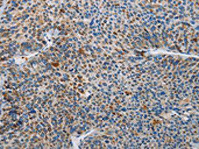 NEK5 Antibody