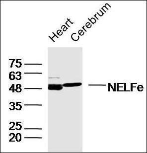 NELFe Rabbit Polyclonal Antibody