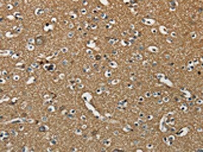 NEMF Antibody