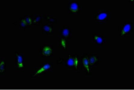 NES Antibody