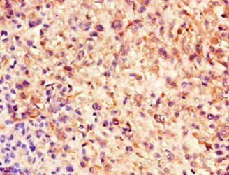 NES Antibody