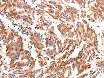 NES Antibody
