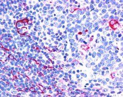 NET1/ARHGEF8 (C Terminus) Antibody