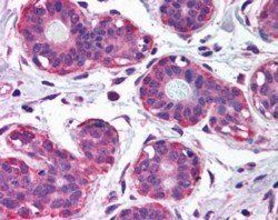 NET1/ARHGEF8 (Internal) Antibody