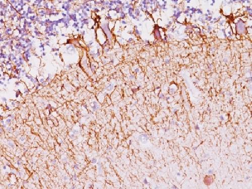 NEFH Antibody