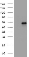 NEFM Antibody