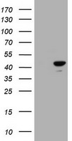 NEFM Antibody