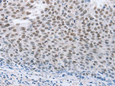 NEUROG2 Antibody