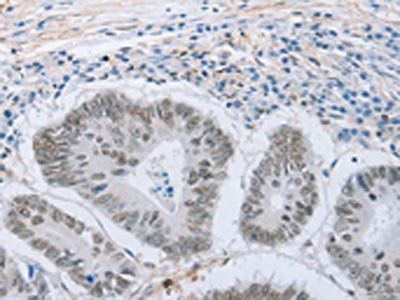 NEUROG2 Antibody