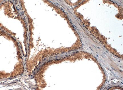 Rabbit anti Human Neurogenin-1 Antibody