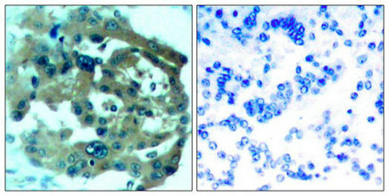 NF2 Antibody