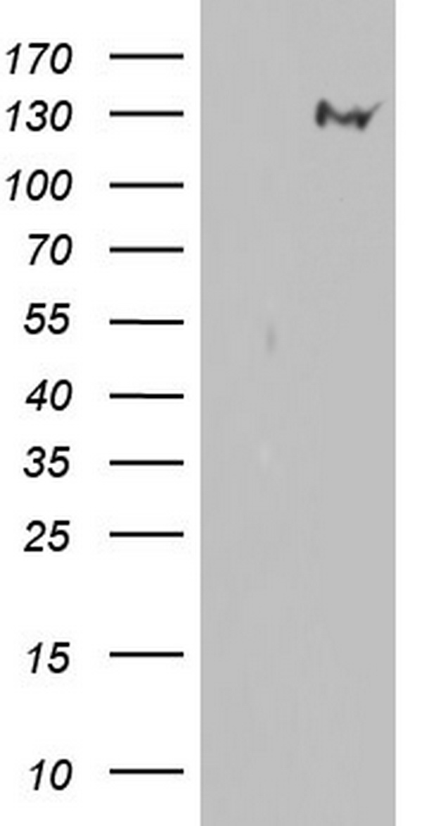 NEFH Antibody