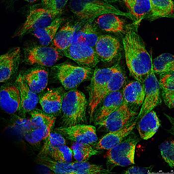 NFκB-p100/p52(Phospho-Ser866) Antibody
