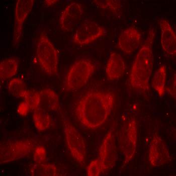 NFκB-p65(Phospho-Ser468) Antibody