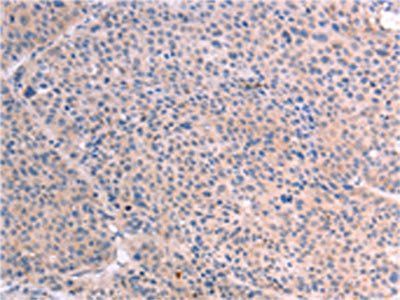RELA Antibody
