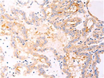 RELA Antibody