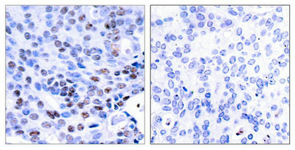 NFKB1 Antibody
