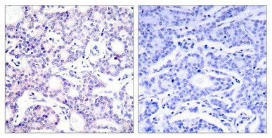 NFKB1 Antibody