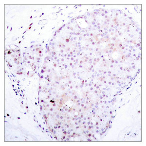NFKB1 Antibody
