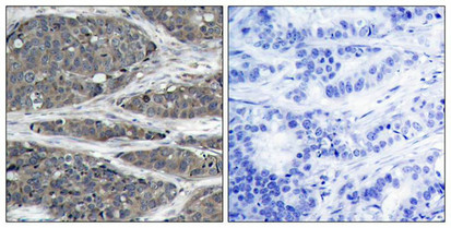 NFKB1 Antibody