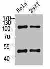 NFKB1 Antibody