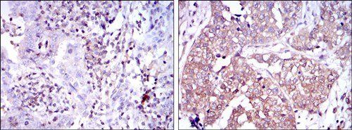 NFKB1 Antibody