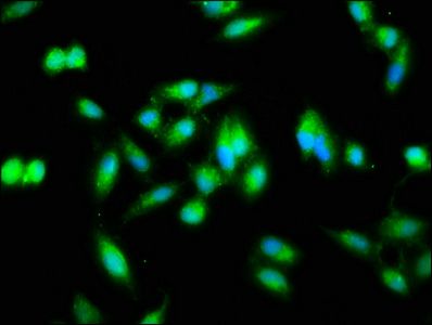 NFKB2 Antibody
