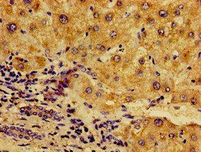 NFKB2 Antibody