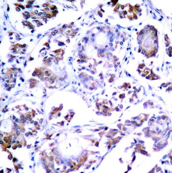 NFκB-p65 (Ab-254) Antibody