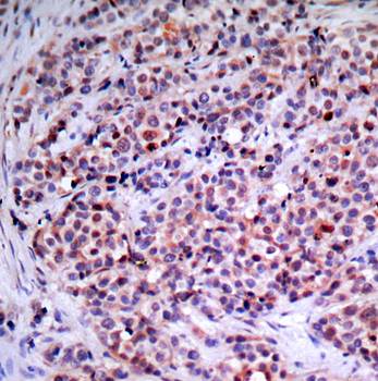 NFκB -p65 (Ab-435) Antibody