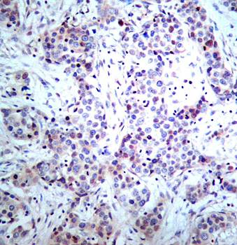 NFκB-p65 (Ab-536) Antibody