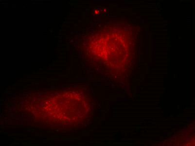 NFKBIA Antibody