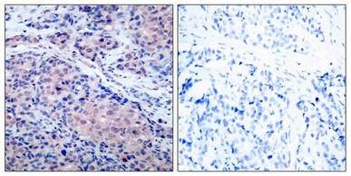 NFKBIA Antibody