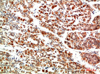 NFKBIA Antibody