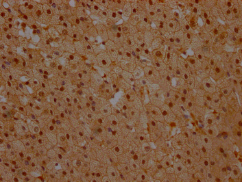 NFKBIA Antibody