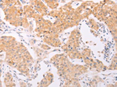 NFKBIE Antibody