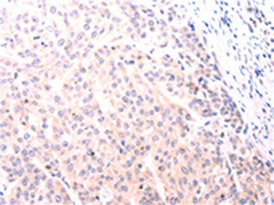 NFKBIE Antibody