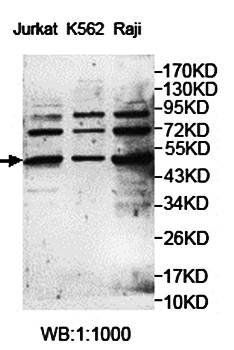 NFKBIE Rabbit Polyclonal Antibody