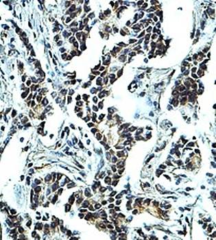 NFKBIE Rabbit Polyclonal Antibody