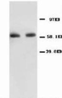 NF-kB p65/RELA/NF Rabbit Polyclonal Antibody
