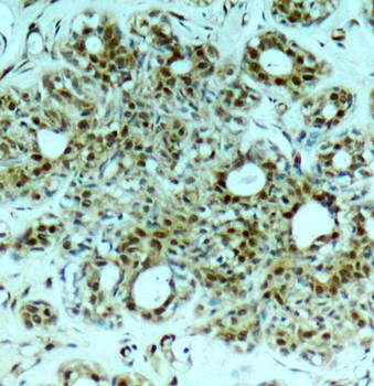 NFκB-p65 (Ab-311) Antibody
