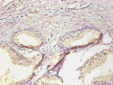 LCN2 Antibody