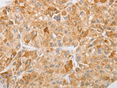NGF Antibody